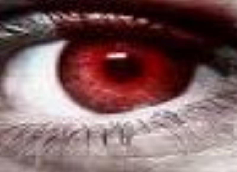 777redeye