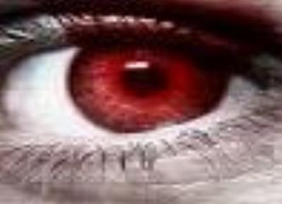 777redeye