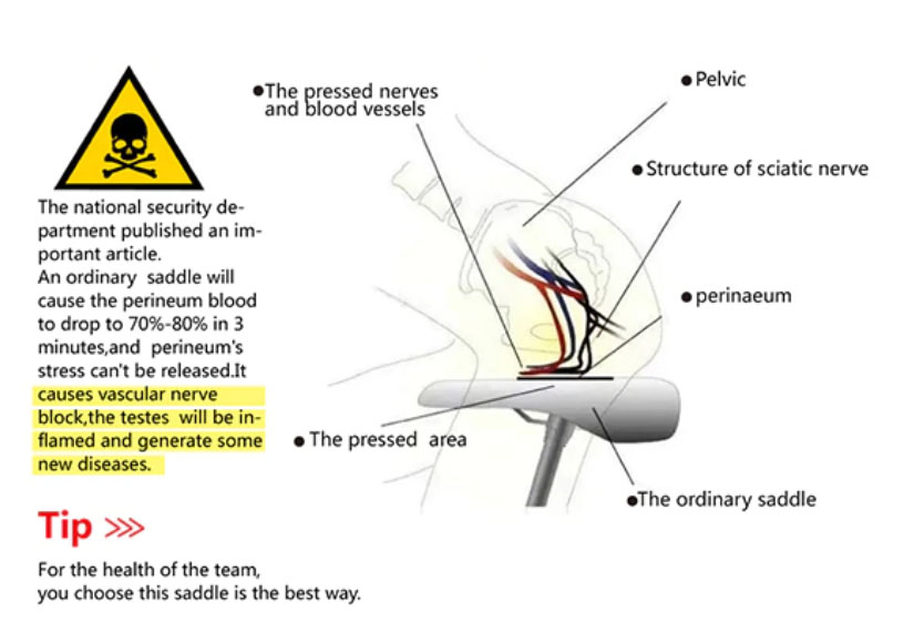 Peroneum